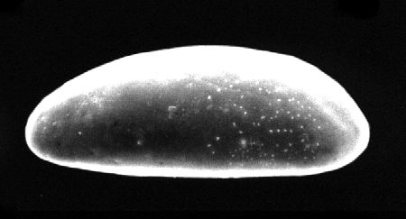 Представитель Семейства Microcytheridae